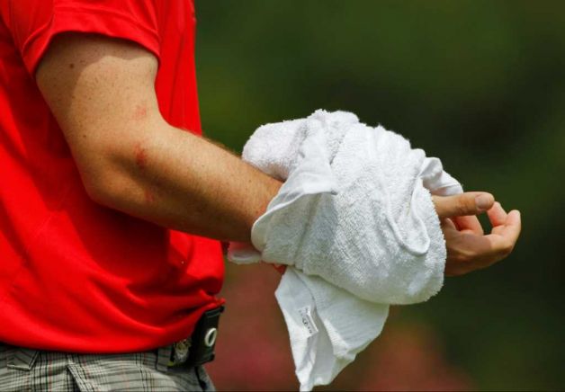 Rory McIlroy's injured right wrist - 2011 US PGA