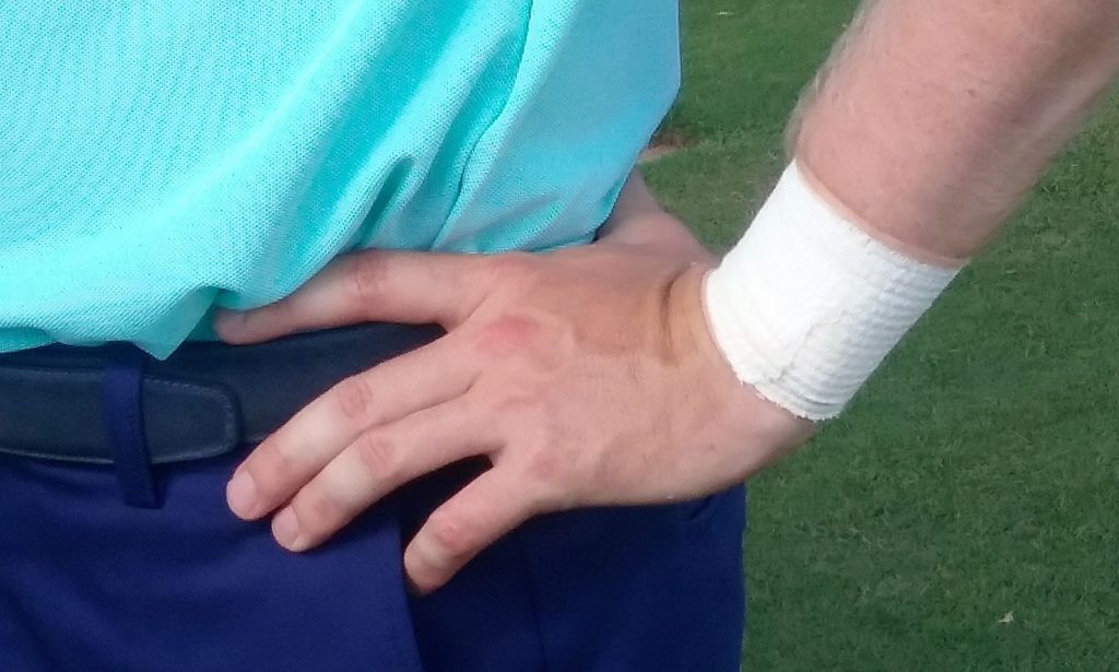 Russell Knox continues to sport strapping on his worrying left wrist. (Photo - www.golfbytourmiss.com)